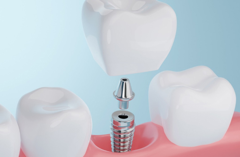 High Desert Dental