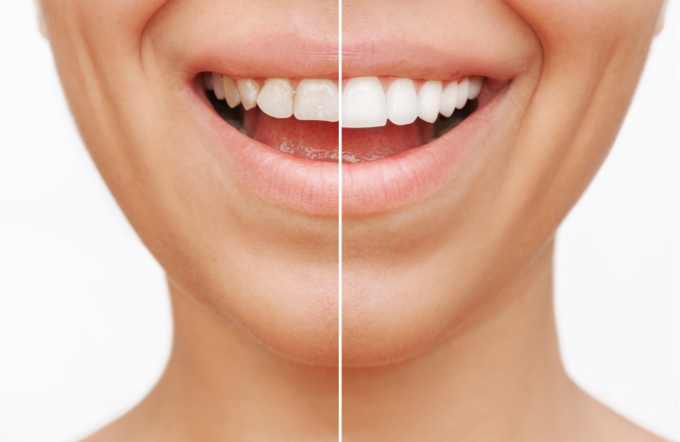 High Desert Dental
